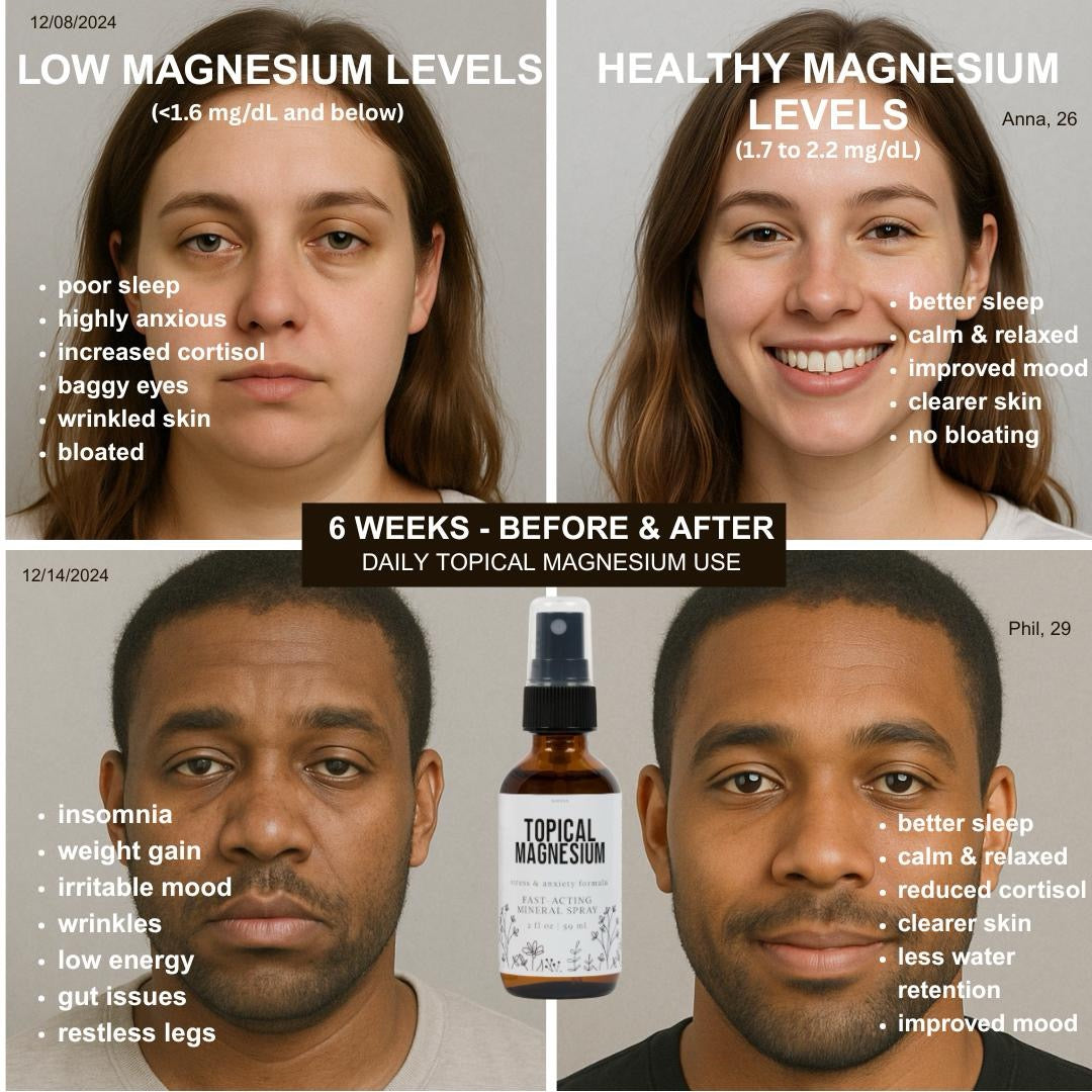 Topical Magnesium Spray