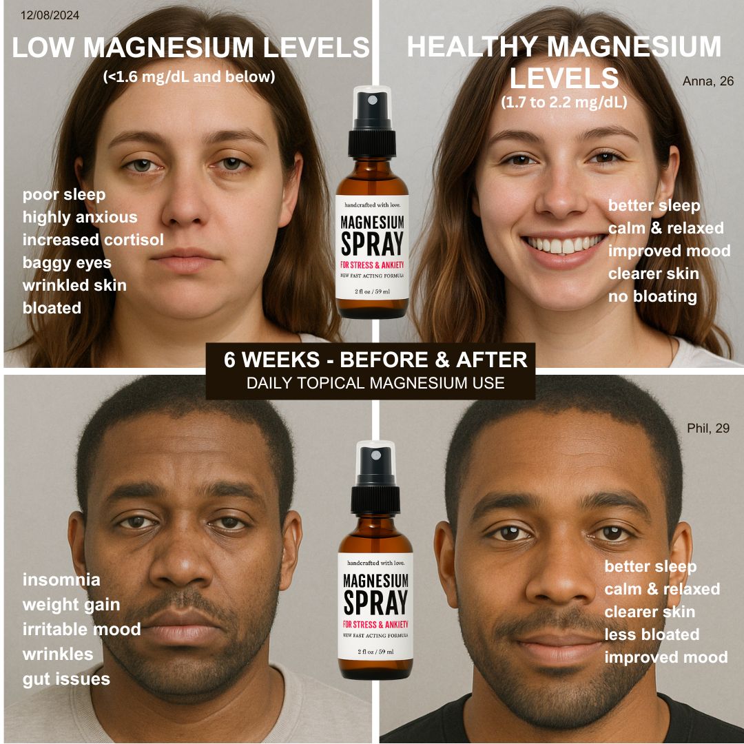 Magnesium Spray 2 fl oz.